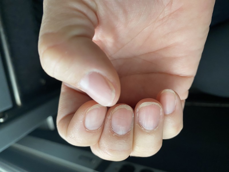 Cùn mủn…. Ngón đếm